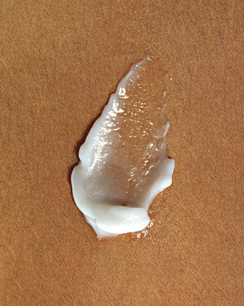Cracked Heels: Why It Happens and How to Actually Fix It Fast